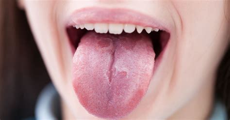 What Your Tongue Reveals About Your Health Oral Health Sharecare