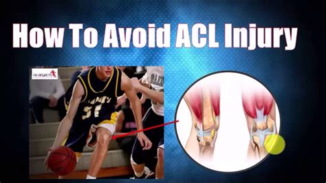 Contrecoup injury of the knee anterior force to tibia in a flexed knee (e.g. ACL Knee Injury Exercises- Identify Your Risk and Prevent ...