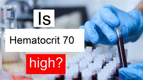 Is Hematocrit 70 High Normal Or Dangerous What Does Hematocrit Level