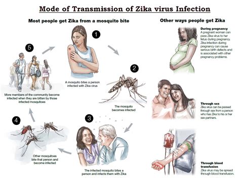 Zika Virus Infection Causes Sign And Symptoms Mode Of Transmission