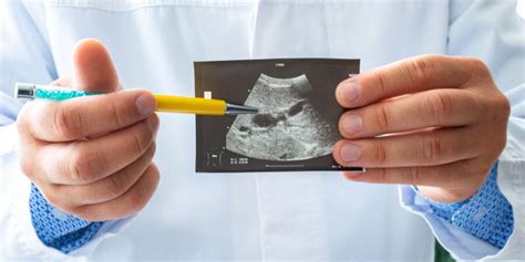 Die dann nachfolgenden kontrollen werden meist schnell klarheit schaffen. Ultraschall: Einfach erklärt im großen ZIAM-Ratgeber für ...