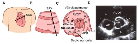 Vista De Eje Corto Paraesternal Labster Theory