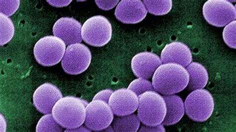 New Diagnostic Test To Detect The Methicillin Resistant Staphylococcus