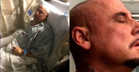 Gregg Valentino Shows Brutal Scar After Throat Cancer Surgery Graphic