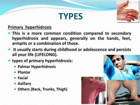 Ppt Hyperhidrosis Powerpoint Presentation Free Download Id1948487