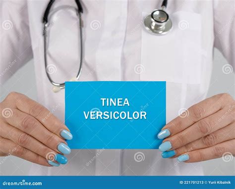 Tinea Versicolor Pityriasis Versicolor Skin Infection On The Back Is A Type Of Fungal Disease