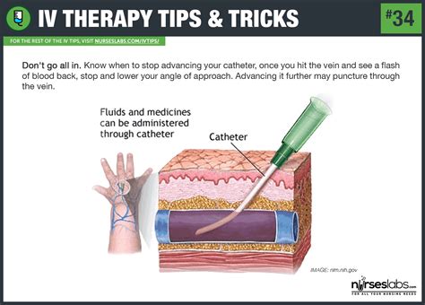 55 Iv Therapy Tips And Tricks How To Hit The Vein In One Shot