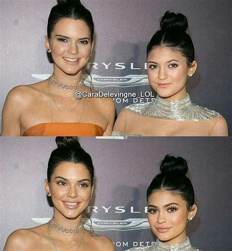 Kendall And Kylie Jenner Plastic Surgery Kylie Jenner Plastic Surgery Kendall Jenner Plastic