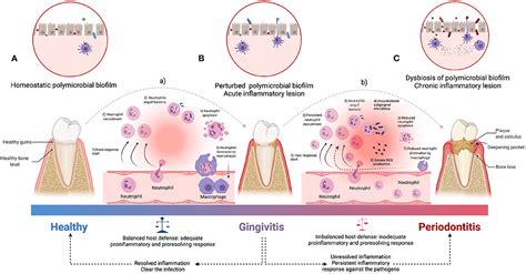 Frontiers Periodontal Inflammation And Systemic Diseases An Overview
