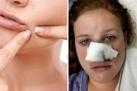 this woman s pimple was the first sign of cancer here s what to look out for mens and womens