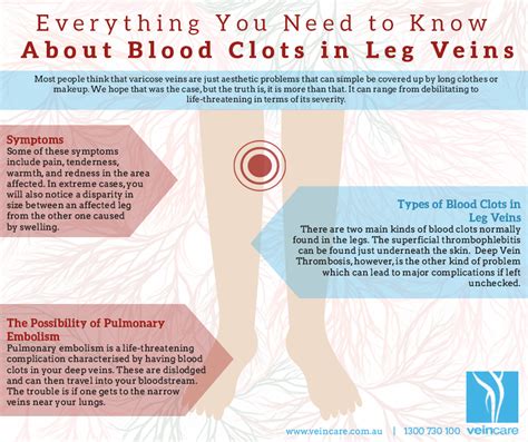Everything You Need To Know About Blood Clots In Leg Veins Social