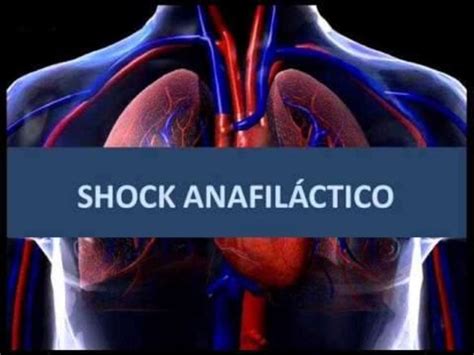 Shock Anafilactico