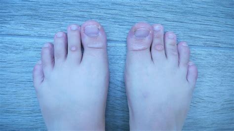 The simple steps of using a foot i have to admit, using a foot file is not the only way to rid yourself of hard skin on your feet but it is arguably the large yet light weight design allows you to work with ease and gives quick. How to Get Rid of Dead Skin on Feet: Step by Step Guide ...