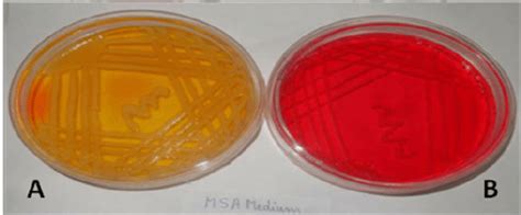 A Staphylococcus Aureus And B Staphylococcus Epidermidis On