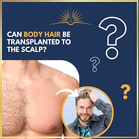 Can Body Hair Be Transplanted Into The Scalp