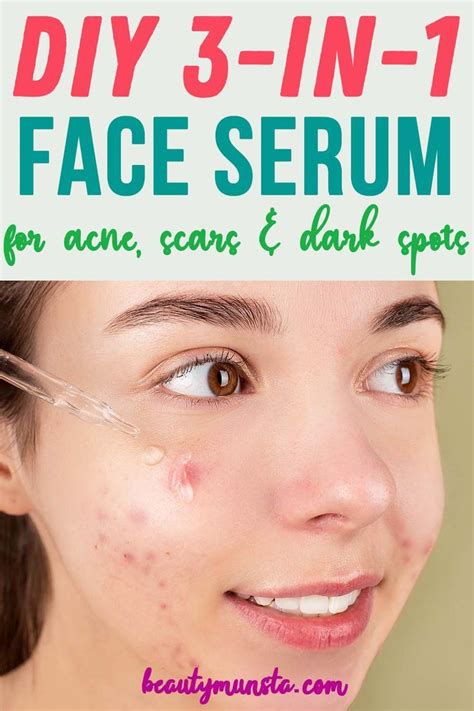 Diy Face Serum For Acne Scars And Dark Spots Artofit