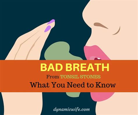 Bad Breath From Tonsil Stones Is It Curable