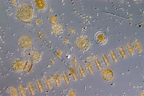 Antarctic Parasite Found In Great Numbers Changing Scientists View Of