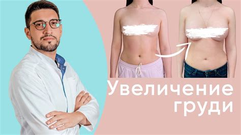 Естественная грудь после маммопластики хирург Мустафаев Эльдар Рашидович YouTube