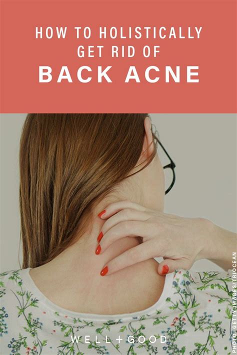 How To Get Rid Of Back Acne Holistically Wellgood Diy Acne