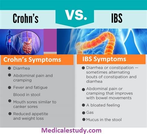 Crohns Syndrome Vs Irritable Bowel Syndrome Causes And Symptoms