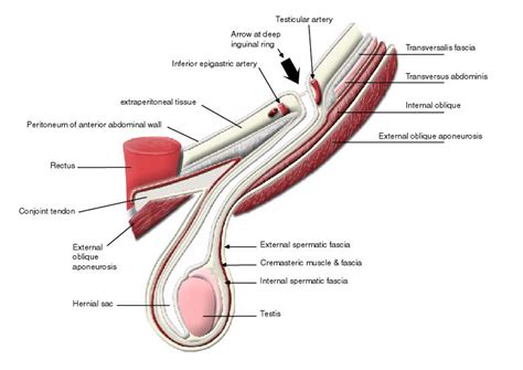 Rcsi Drawing Fascia And Structures Of Spermatic Cord And Testis