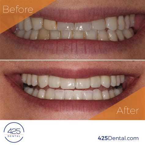 Before And After 425 Dental