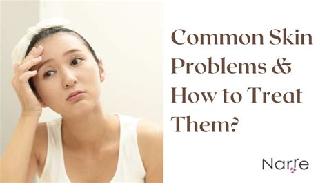 Ppt Common Skin Problems And How To Treat Them Powerpoint Presentation