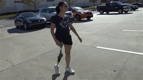 Walks For First Time Hip Disarticulate Amputee Best Prosthesis