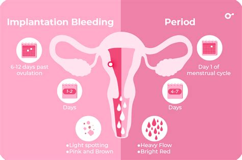 Menstrual Bleeding Vs Implantation Bleeding