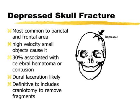 Ppt Head Neck And Spinal Trauma Powerpoint Presentation Free