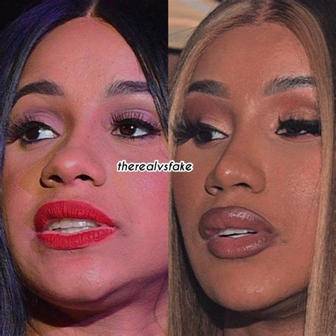Cardi B Before And After Nose Job And Fillers Celebrity Plastic Surgery