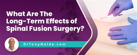 What Are The Long Term Effects Of Spinal Fusion Surgery