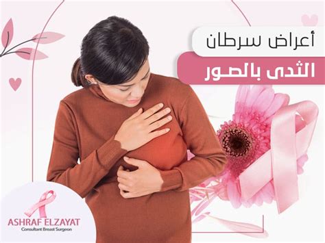 أعراض سرطان الثدي بالصور إياكِ وإهمالها، اعرفيها مع د أشرف