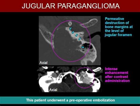 Majeja84 Adlı Kullanıcının Radiologija Panosundaki Pin