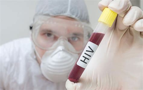 Diagnosis Of Hiv Aids A Proper Treatment Starts With Proper Diagnosis