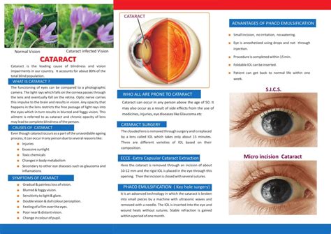Cataract Ahalia Foundation Eye Hospital