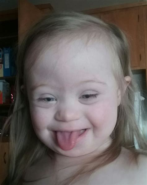Pin On Beautiful Kids With Down Syndrome