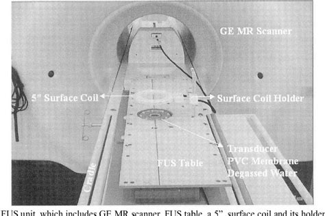 Figure 1 From Magnetic Resonance Image Guided Focused Ultrasound