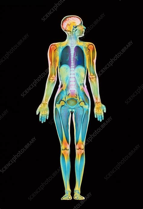 Internal human organs set people anatomy stock vector 393922969. Coloured MRI scan of a whole human body (female) - Stock Image - P835/0037 - Science Photo Library