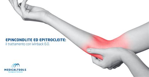 Fisioterapia Per Epicondilite Ed Epitrocleite Winback 60 Medical Tools