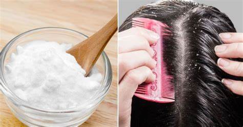Instructions to Treat Dandruff With Salt
