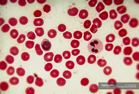 Light Micrograph Of Human Red Blood Cells Erythrocytes With Two
