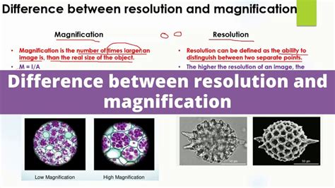 Difference Between Resolution And Magnification Microscopy A Level
