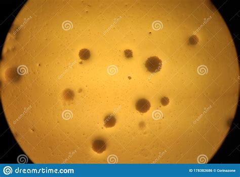 Microscope View Of Candida Albicans Colonies Stock Photo Image Of