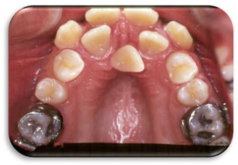 Plan De Tratamiento En Ortodoncia Y Ortopedia Maxilar