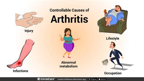 What Are The Major Causes Of Arthritis Circlecare