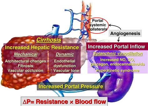 The Management Of Portal Hypertension Rational Basis Available