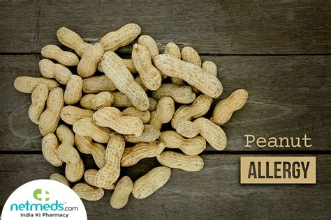 Peanut Allergy Causes Symptoms And Treatment