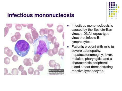 Ppt Alterations In White Blood Cells Powerpoint Presentation Free